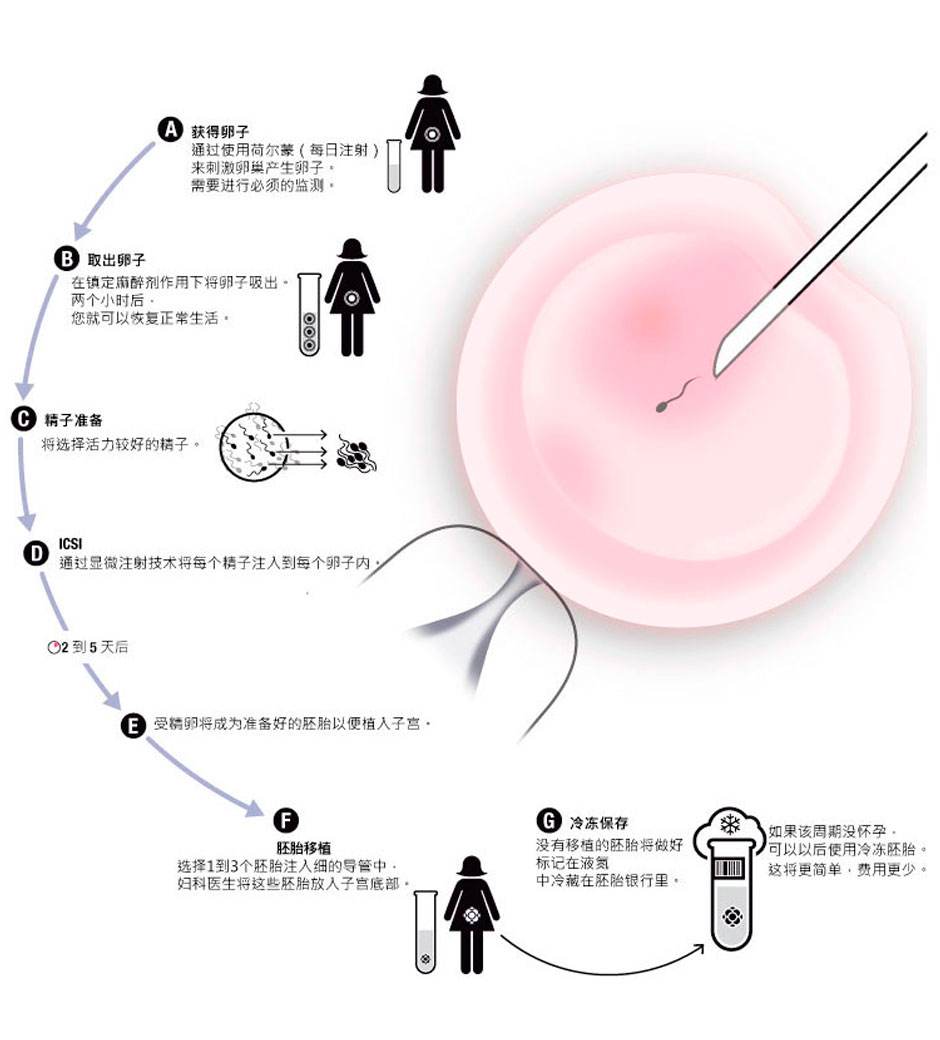 尖端试管婴儿技术解析